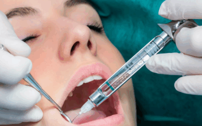 Préparer la bouche avant un implant ou une prothèse : pourquoi c’est essentiel ?